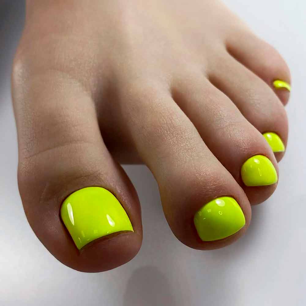 Neon Yellow